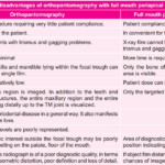 Advantages And Disadvantages Of Orthopantomography 1