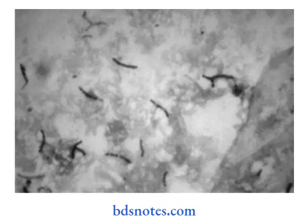 Bacteriology Mycobacteria Mycobacterium tuberculosis