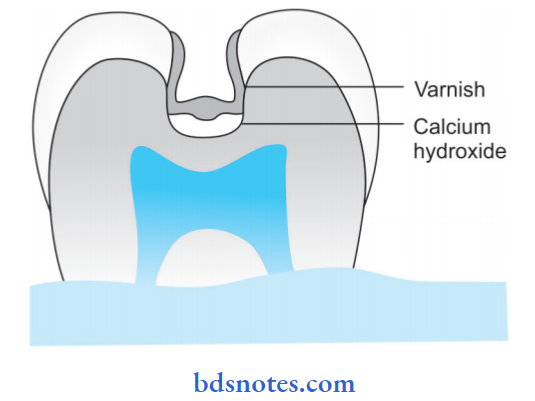 Base Linear And Varnish Application of varnish in a tooth
