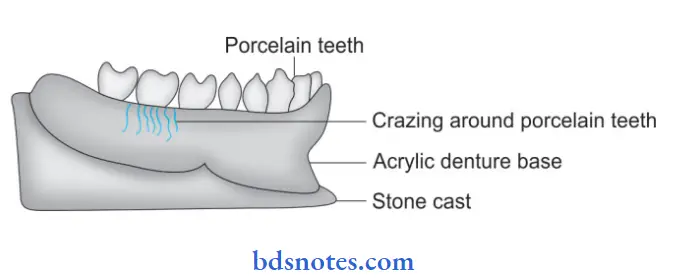 Dental Resins And Polymers Crazing In Denture base