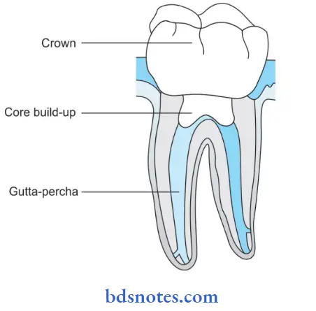 Endodontic Materials Gutta–Percha in root canal