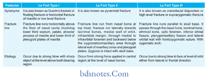 Fractures of Bone differentiating features of le Fort type i,ii,and iii fractures in table