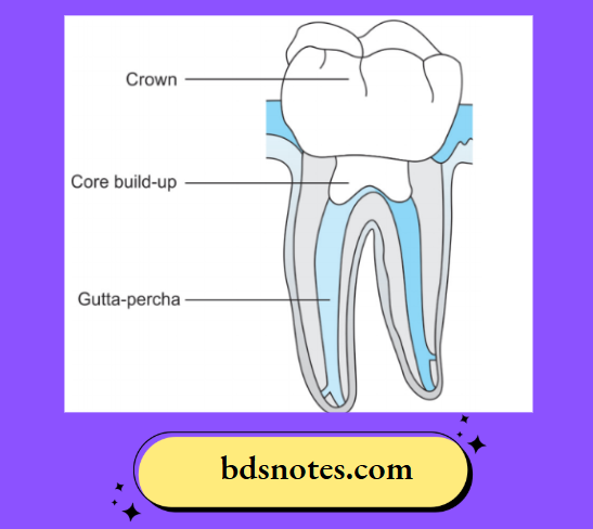Gutta Percha in root canal
