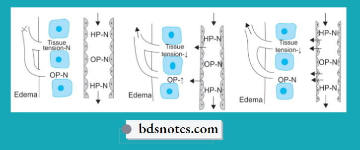 Hemodynamic Changes-Mechanism Of-Edema