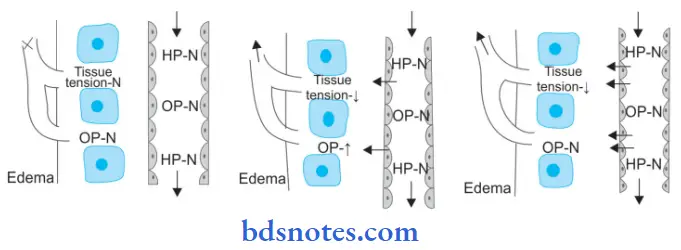 Hemodynamic Changes Mechanism Of Edema