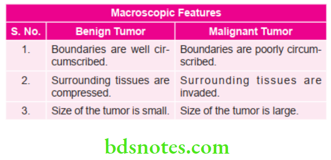 Oral Medicine Malignant Tumors Of Jaws Macroscopic Features 1