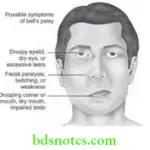 Oral Medicine Orofacial Pain Bell's Palsy