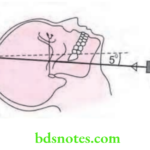 Oral Radiology Extraoral Radiographic Techniques Positioning Of Submentovertex Projection