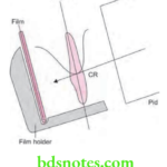 Oral Radiology Intraoral Radiographic Techniques Long Cone Technique