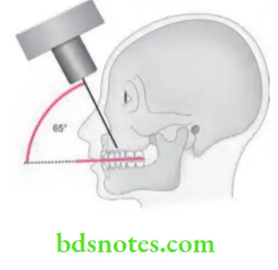 Oral Radiology Intraoral Radiographic Techniques Projection Central Ray With Point Of Entry From Bridge Of Nose