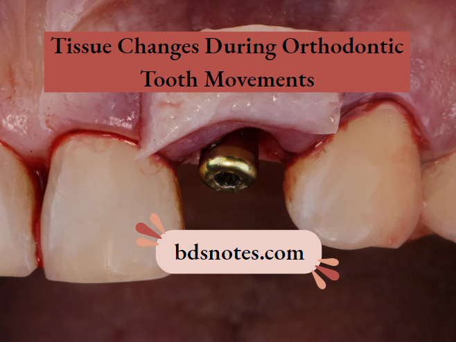 Orthodontic-Tooth-Movement-Timeline