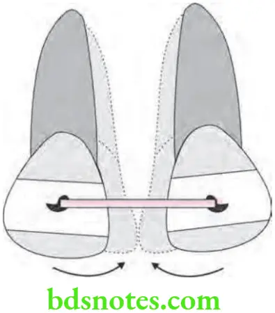 Orthodontics Anchorage In Orthodontics Simple anchorage