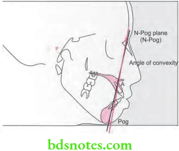 Orthodontics Cephalometrics Angle of convexity