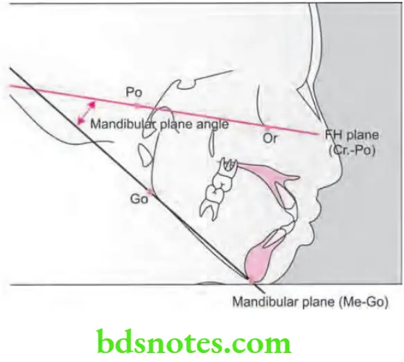 Orthodontics Cephalometrics Mandibular plane angle