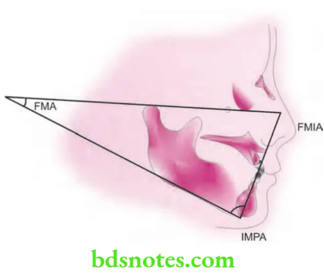 Orthodontics Cephalometrics Tweed's Diagnostic Triangle