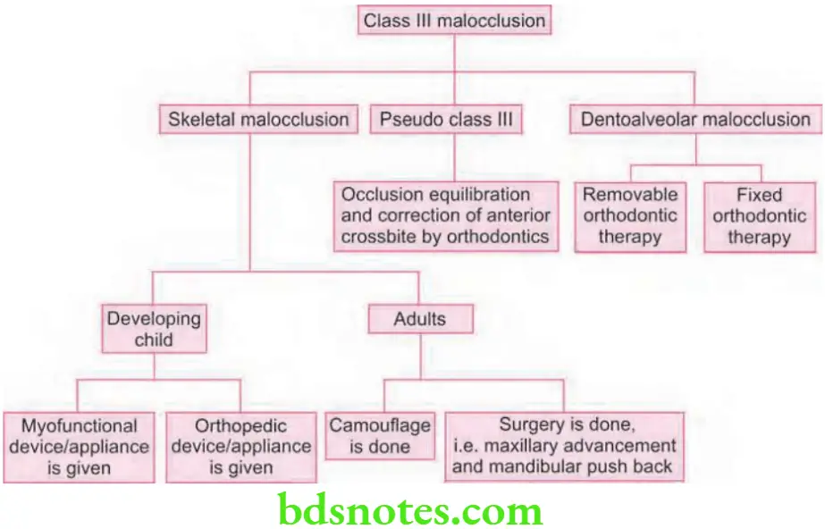 Orthodontics Management Of Class 3 Malocclusion Management of Case of Developing Class