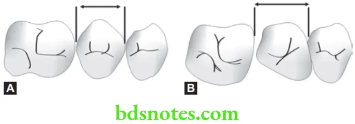 Orthodontics Methods Of Gaining Space Derotation of teeth