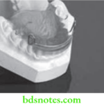 Orthodontics Myofunctional Appliances Activator