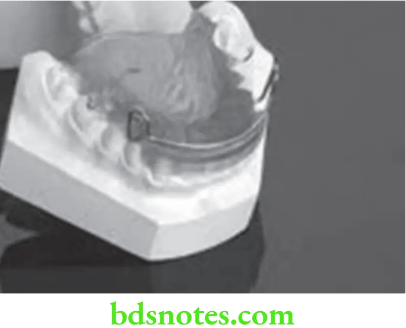 Orthodontics Myofunctional Appliances Activator