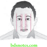 Orthodontics Orthodontic Diagnosis Facial Symmetry
