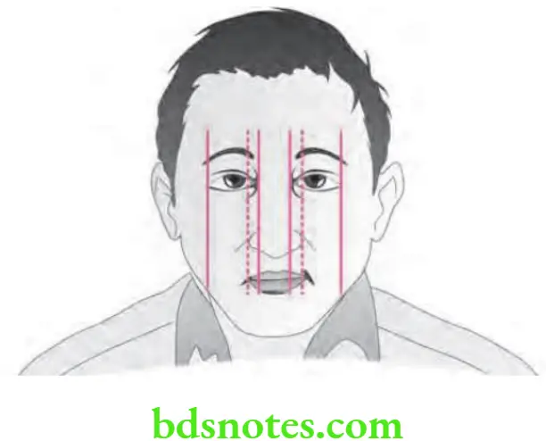 Orthodontics Orthodontic Diagnosis Facial Symmetry