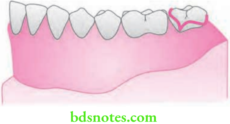 Adams Clasp Theory And Fabrication - BDS Notes