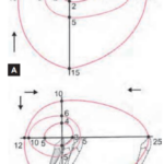 Orthodontics Surgical Orthodontics Maxilla and Mandible envelope of discrepancy