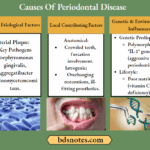 Periodontal Disease Etiology