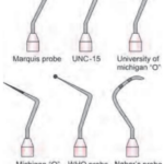 Periodontics Periodontal Instrumentation Periodontal probes