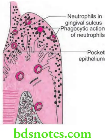 Periodontics Periodontal Pocket Phagocytic action of neutrophils