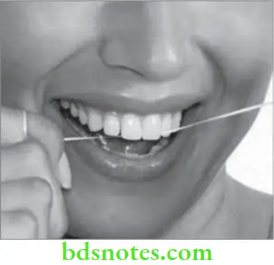Periodontics Plaque Control Dental floss