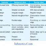 STOMACH How we diffrentiate between malignant and benign ulcer