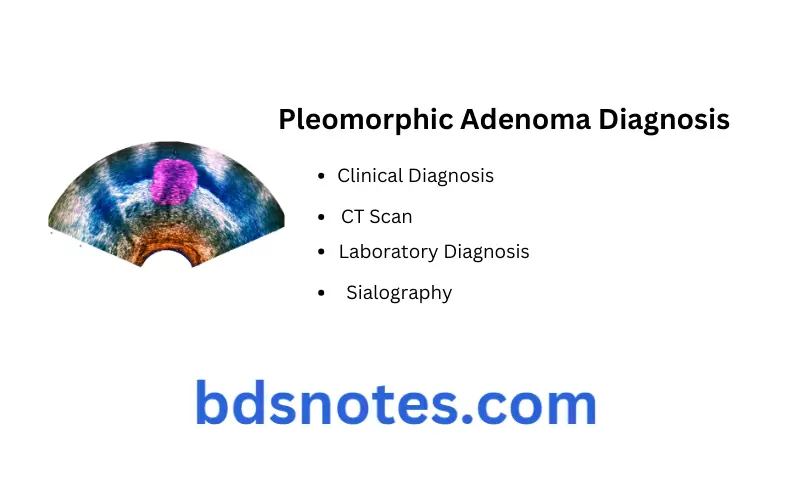 Salivary Gland Disorders Question And Answers Pleomorphic Adenoma Diagnosis