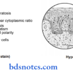 The Oral Cavity And Salivary Glands Leukoplakia