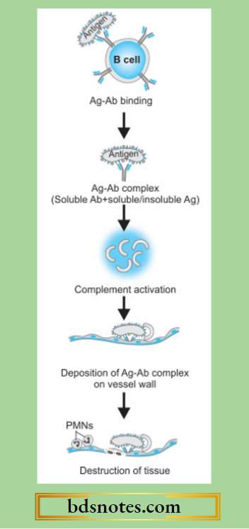 Type-3-Hypersensitivity-Reaction