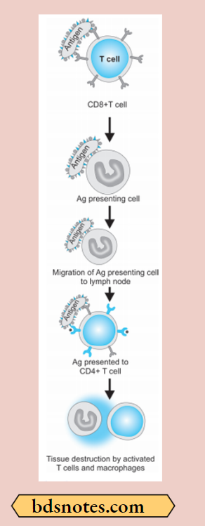 Type-4-Hypersensitivity-Reaction