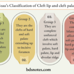 Veau’s Classification of Cleft lip and cleft palate