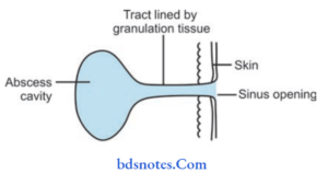 Paricular Pit Preauricular Pits - BDS Notes