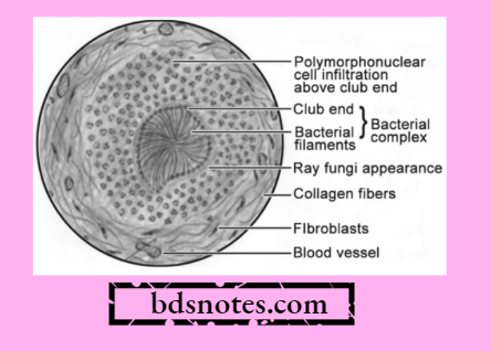 Actinomycosis H-E Stain