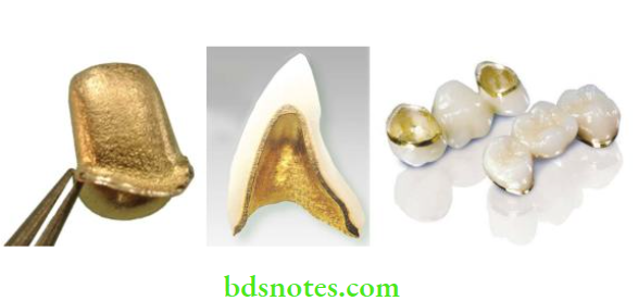 Ceramic Systems Classification And Types Of Metal Ceramic Systems Notes 