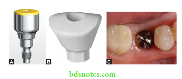 Dental Implant Materials Notes BDS Notes Dental Implant Materials Notes BDS Notes