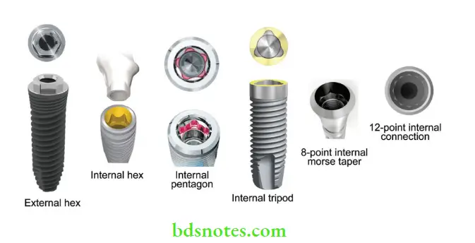Dental Implant Materials Various types of implant abutment connections