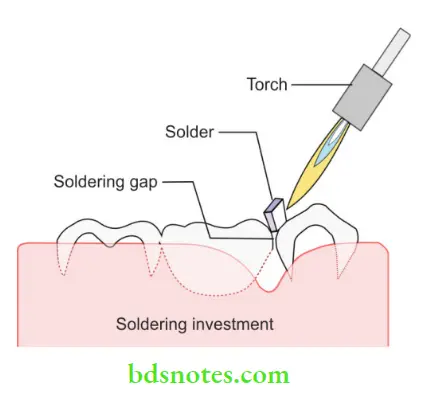 Dental Investments And Refractory Materials Soldering procedure
