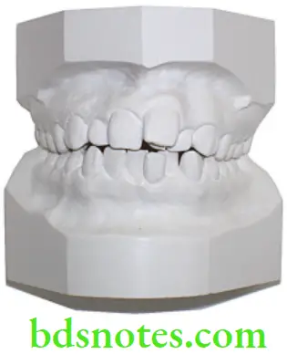 Dental Materials Model Cast and Die Materials A study model