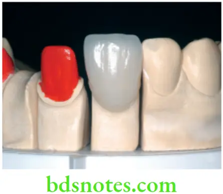 Dental Materials Model Cast and Die Materials Dies are used to fabricate dental restorations