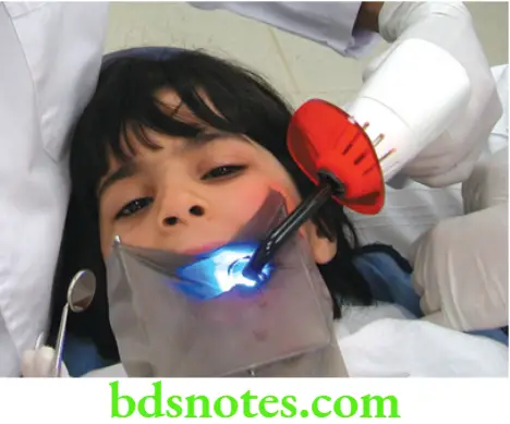 Dental Materials Resin based Composites and Bonding Agents A dental curing light in the visible blue range