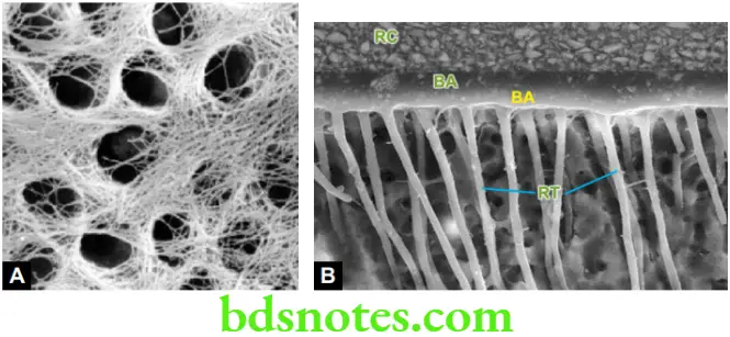Dental Materials Resin based Composites and Bonding Agents SEM of etched enamel non desiccated dentin showing collagen mesh