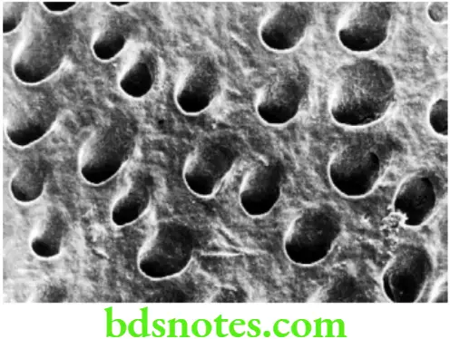 Dental Materials Resin based Composites and Bonding Agents SEM of ethced dentin showing the open dentinal tabules