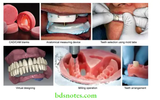 Denture Resins And Polymers CAD or CAM system (AvaDent)