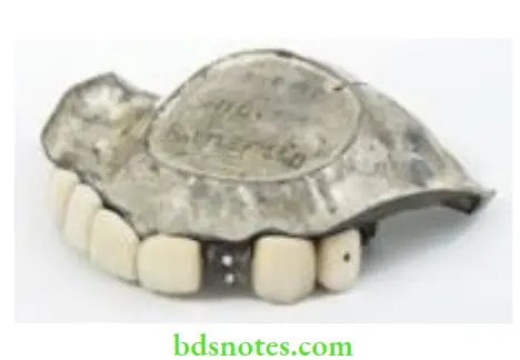 Denture Resins And Polymers Metal denture base made from German silver which belonged to a soldier from the Battle of Shiloh 1862
